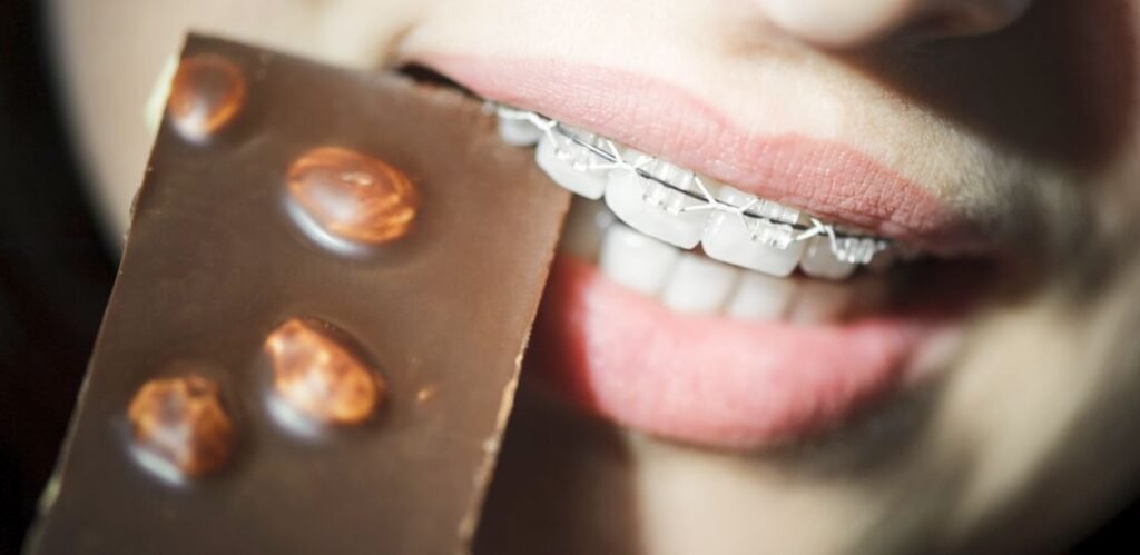 Tips for Enjoying Chocolate with Braces